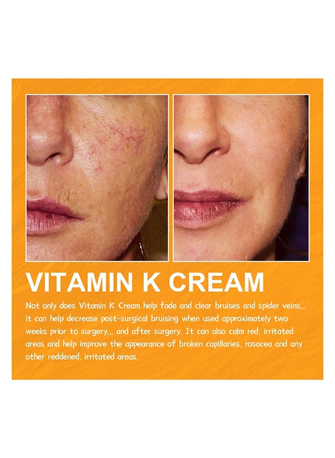 إيلهو كريم فيتامين ك للأوردة الدوالي، كريم مهدئ للساقين، كريم علاج الأوردة الدموية والدوالي العنكبوتية، يحسن الدورة الدموية، يخفف التورم والألم بسرعة ٦٠ جرام - Image 5